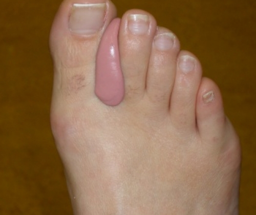 Podologe